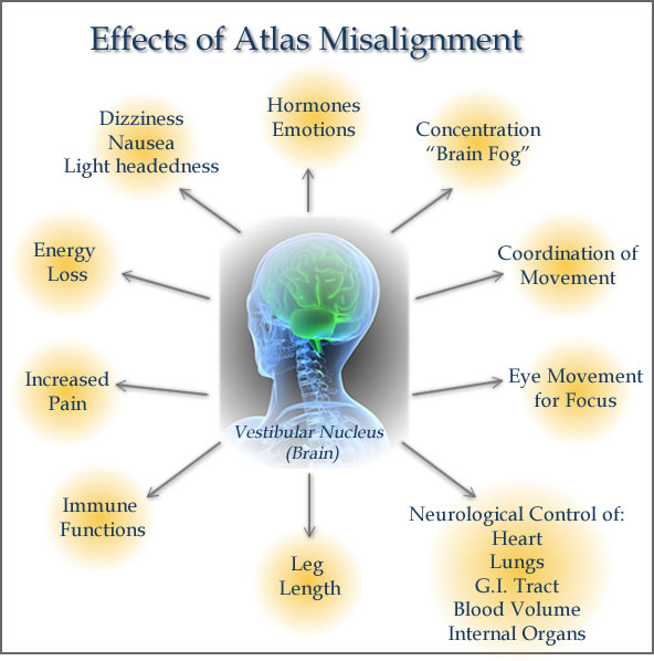 Subluxation Symptoms Chart