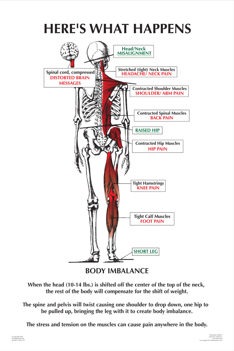 Hip Location Chart